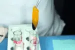 Venipuncture and PRF Course | Dental & Facial Aesthetics - Image 2