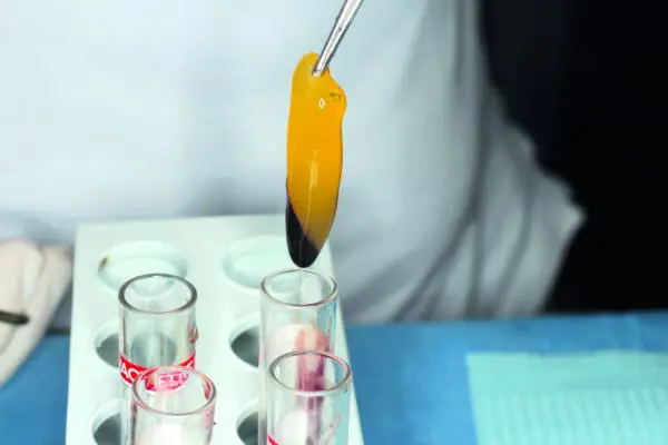 Venipuncture and PRF Course | Dental & Facial Aesthetics - Image 2
