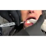 Armor Dental Scan Mate Professional - Image 2