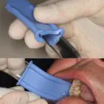 Armor Dental Tissue Pro - Minnesota Soft Sleeves - Image 2