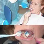 Armor Dental Comfort Soft - Single Patient - Image 4