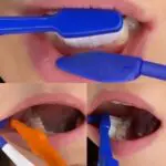 Armor Dental Mouth Mate Home Retractor - Image 3