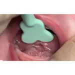 Armor Dental Tongue Guide - Image 3