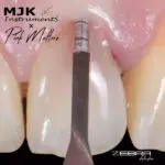 MJK Zebra Perio Blades - Image 2