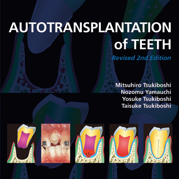 book cover, blue and black with illustration