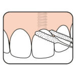 bridge demonstration